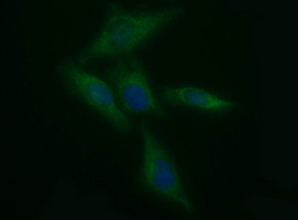 TH Antibody in Immunocytochemistry (ICC/IF)