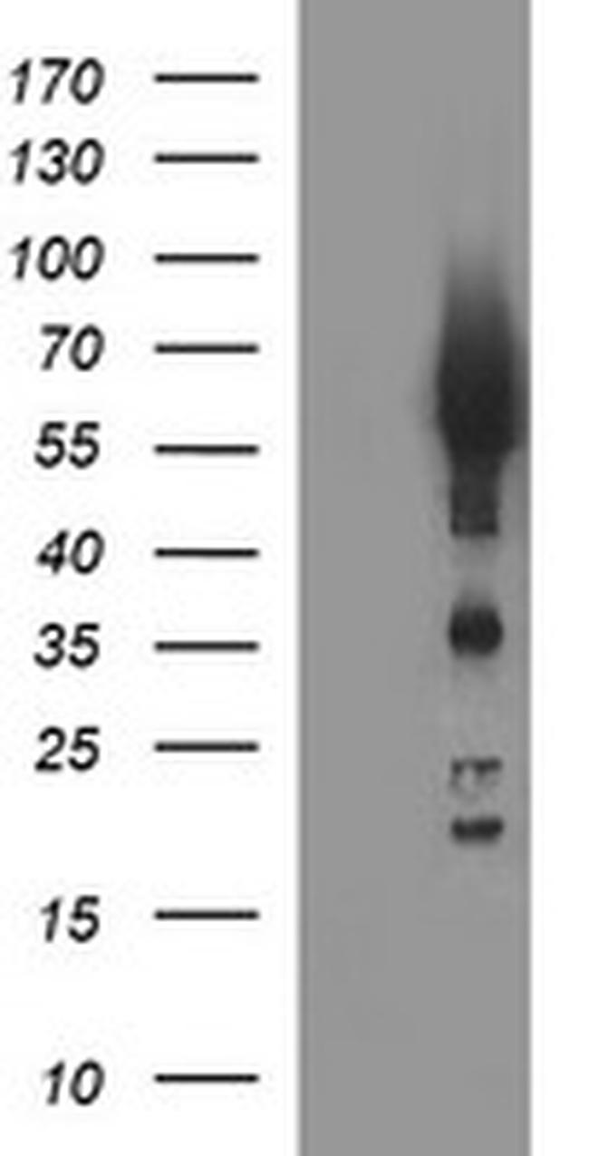 TH Antibody in Western Blot (WB)