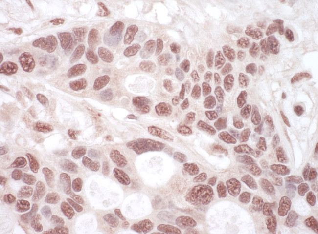 THOC1 Antibody in Immunohistochemistry (IHC)