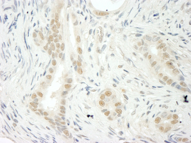 THOC5 Antibody in Immunohistochemistry (IHC)