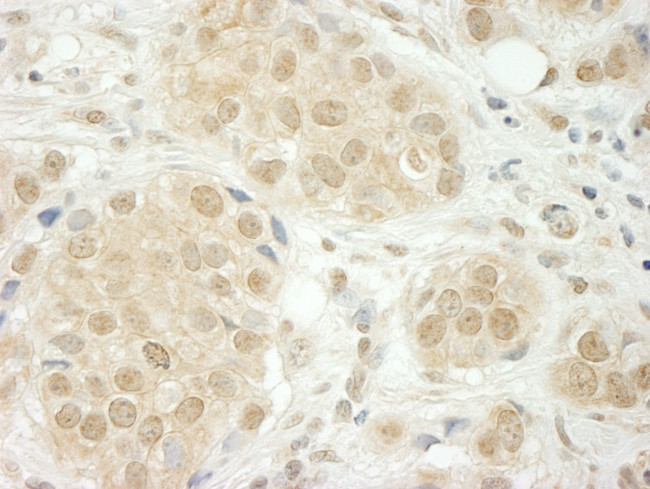 THOC5 Antibody in Immunohistochemistry (IHC)