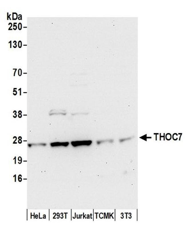 THOC7 Antibody in Western Blot (WB)