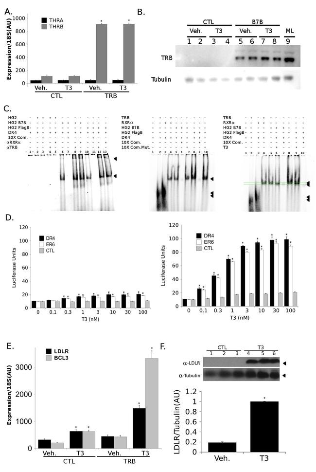 THRB Antibody in Western Blot, Gel Shift (WB, GS)