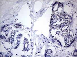 TIA1 Antibody in Immunohistochemistry (Paraffin) (IHC (P))