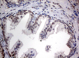 TIA1 Antibody in Immunohistochemistry (Paraffin) (IHC (P))