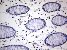 TIA1 Antibody in Immunohistochemistry (Paraffin) (IHC (P))