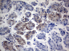 TIA1 Antibody in Immunohistochemistry (Paraffin) (IHC (P))