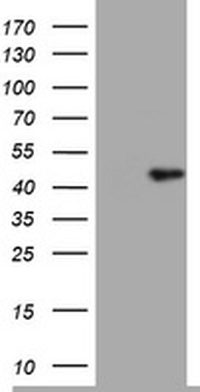 TIA1 Antibody in Western Blot (WB)