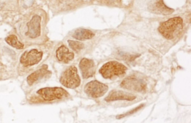 TIGAR Antibody in Immunohistochemistry (IHC)