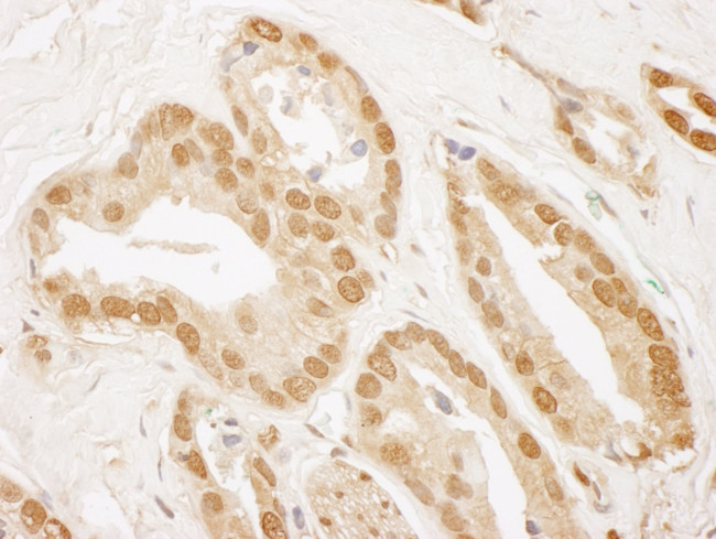 TIGAR Antibody in Immunohistochemistry (IHC)