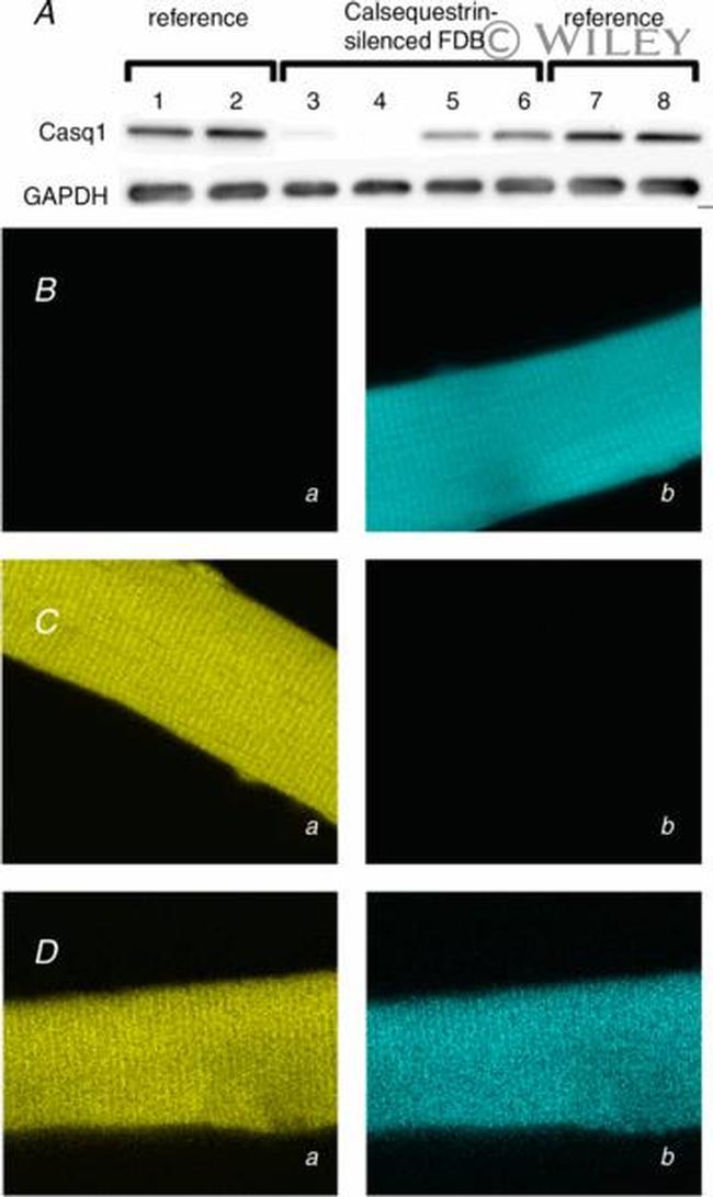 Calsequestrin Antibody in Western Blot (WB)