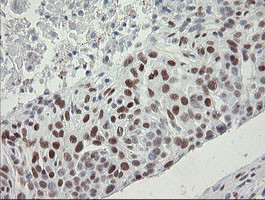 TLE1 Antibody in Immunohistochemistry (Paraffin) (IHC (P))