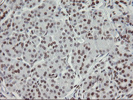 TLE1 Antibody in Immunohistochemistry (Paraffin) (IHC (P))