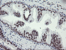 TLE1 Antibody in Immunohistochemistry (Paraffin) (IHC (P))