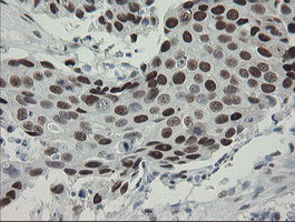 TLE1 Antibody in Immunohistochemistry (Paraffin) (IHC (P))