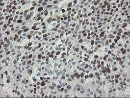 TLE1 Antibody in Immunohistochemistry (Paraffin) (IHC (P))