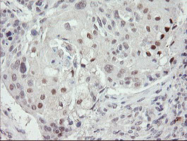 TLE1 Antibody in Immunohistochemistry (Paraffin) (IHC (P))