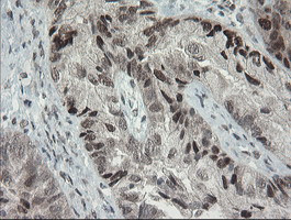 TLE1 Antibody in Immunohistochemistry (Paraffin) (IHC (P))