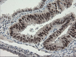 TLE1 Antibody in Immunohistochemistry (Paraffin) (IHC (P))