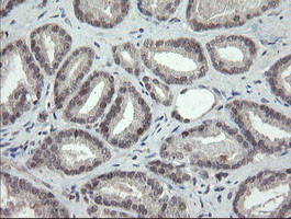 TLE1 Antibody in Immunohistochemistry (Paraffin) (IHC (P))