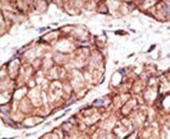 TLR5 Antibody in Immunohistochemistry (IHC)