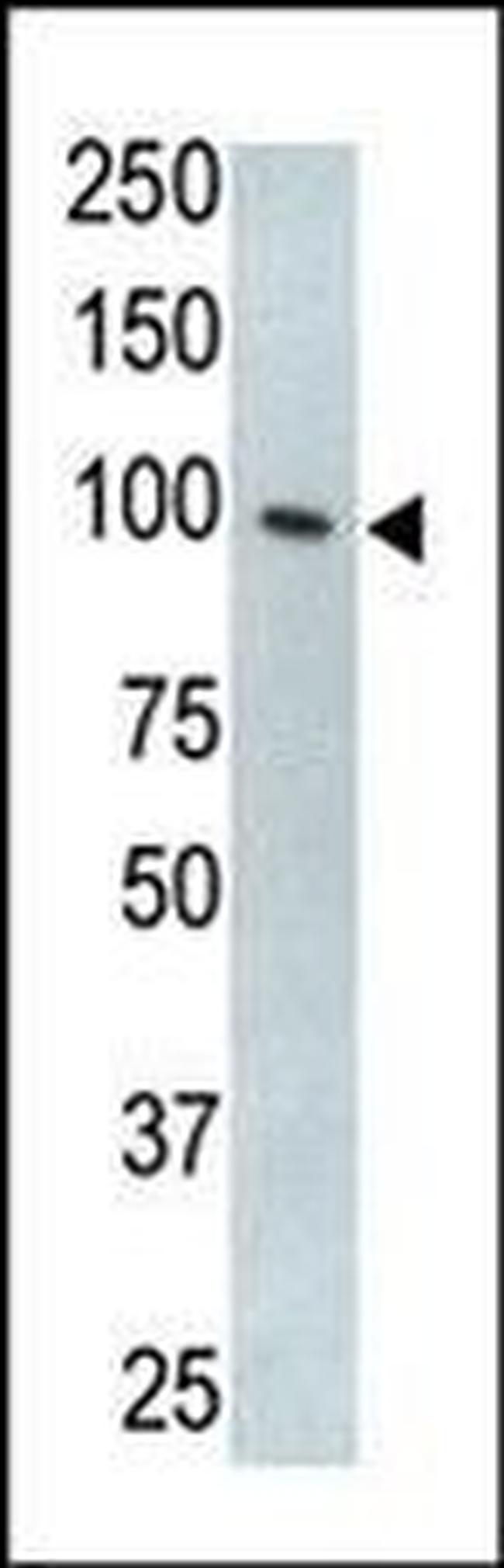 TLR5 Antibody in Western Blot (WB)