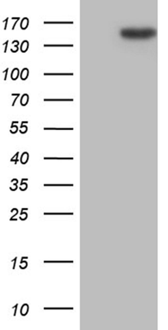 TLR8 Antibody in Western Blot (WB)