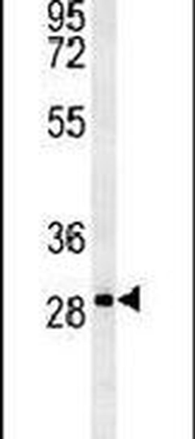 TMEM165 Antibody in Western Blot (WB)