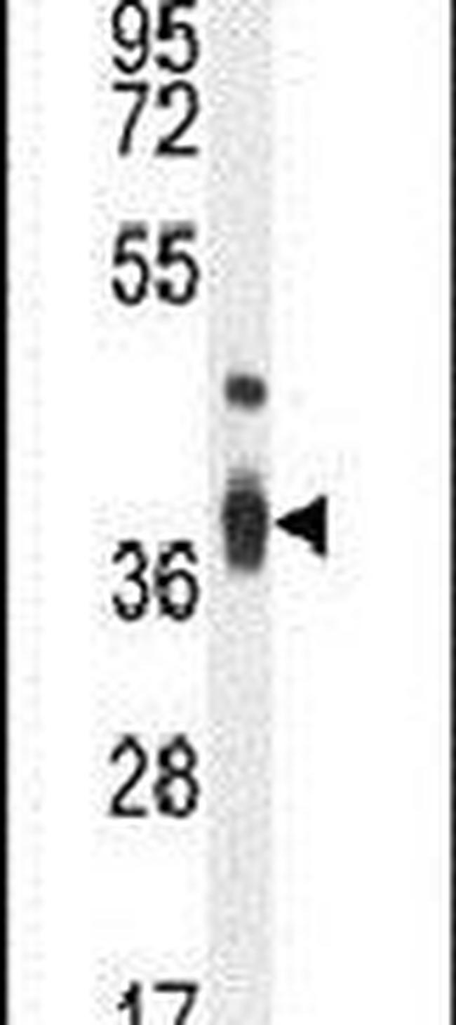 TMBIM4 Antibody in Western Blot (WB)