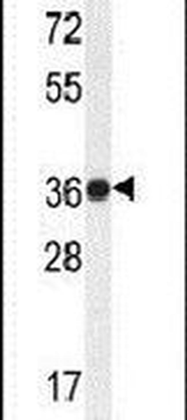 TMBIM4 Antibody in Western Blot (WB)