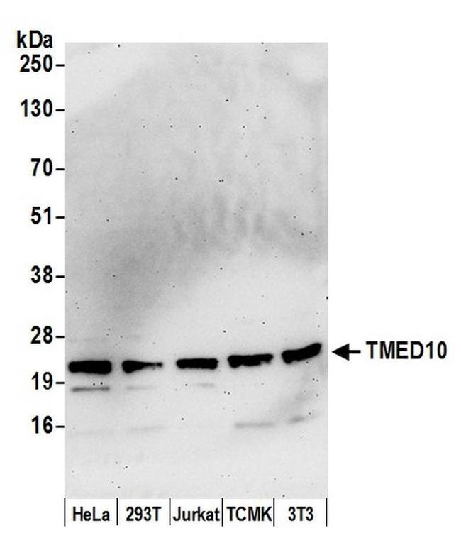 TMED10/TMP21 Antibody in Western Blot (WB)