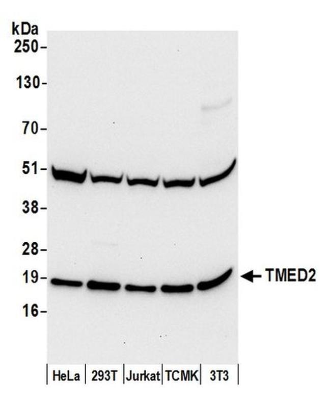 TMED2 Antibody in Western Blot (WB)