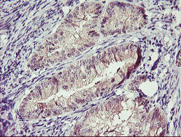 TMEFF2 Antibody in Immunohistochemistry (Paraffin) (IHC (P))