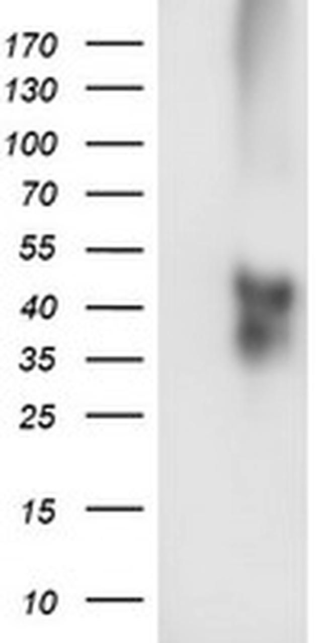 TMEFF2 Antibody in Western Blot (WB)