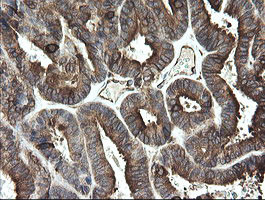 TMEM173 Antibody in Immunohistochemistry (Paraffin) (IHC (P))