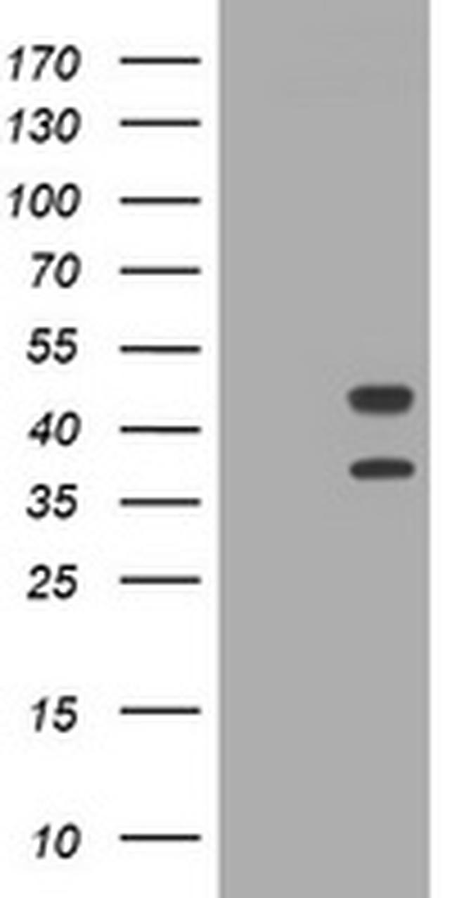 TMEM173 Antibody in Western Blot (WB)