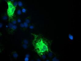 TMEM80 Antibody in Immunocytochemistry (ICC/IF)