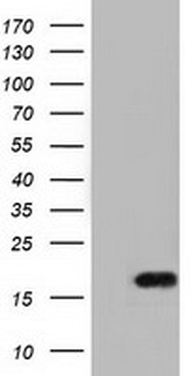 TMEM80 Antibody in Western Blot (WB)