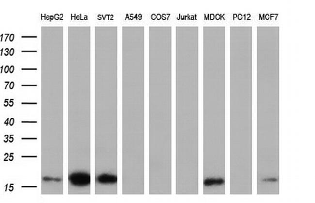 TMEM80 Antibody in Western Blot (WB)