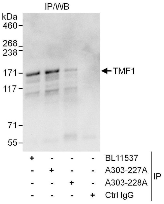 TMF1 Antibody in Immunoprecipitation (IP)