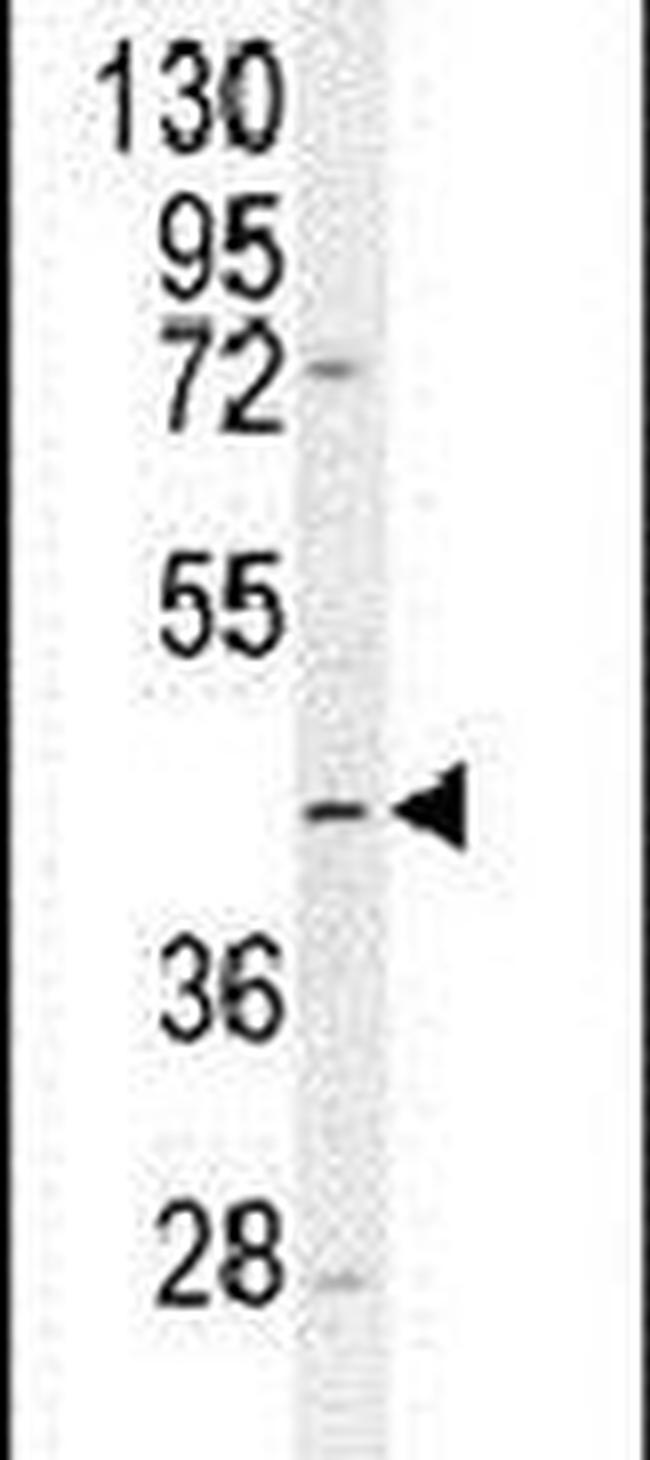 TMLHE Antibody in Western Blot (WB)