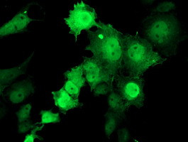 TMOD1 Antibody in Immunocytochemistry (ICC/IF)