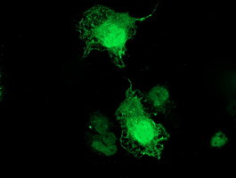 TMOD1 Antibody in Immunocytochemistry (ICC/IF)