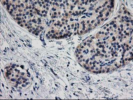 TMOD1 Antibody in Immunohistochemistry (Paraffin) (IHC (P))