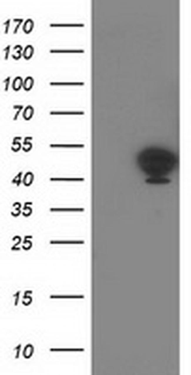 TMOD1 Antibody in Western Blot (WB)