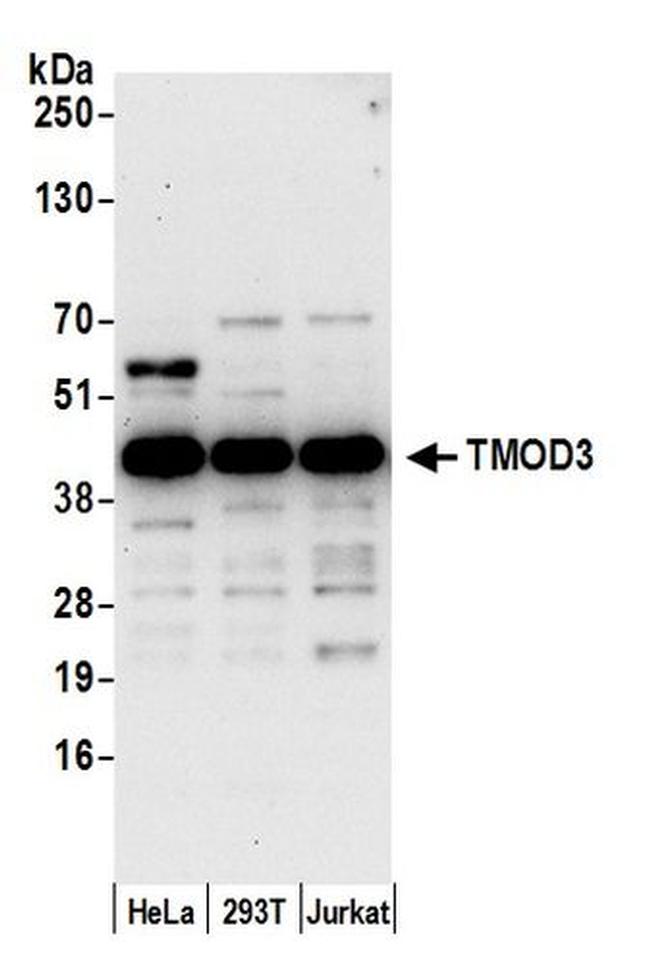 TMOD3 Antibody in Western Blot (WB)