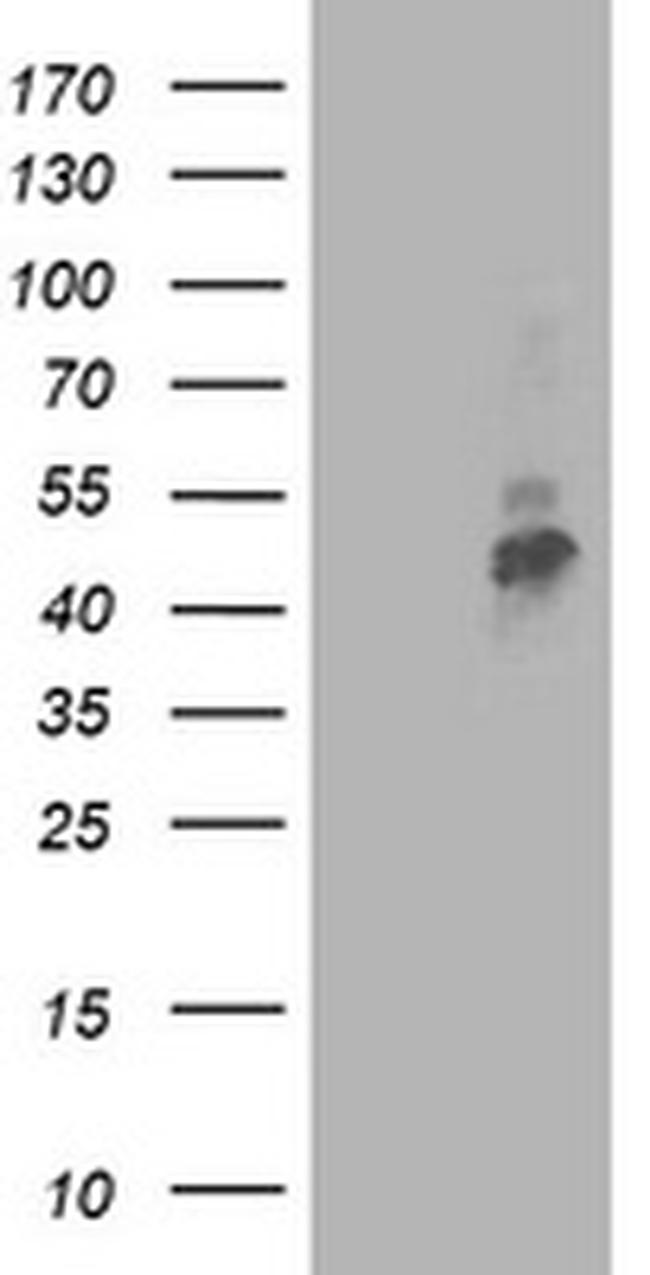 TMPRSS5 Antibody in Western Blot (WB)