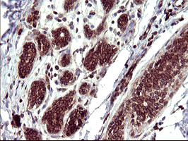 TMX1 Antibody in Immunohistochemistry (Paraffin) (IHC (P))