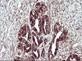 TMX1 Antibody in Immunohistochemistry (Paraffin) (IHC (P))