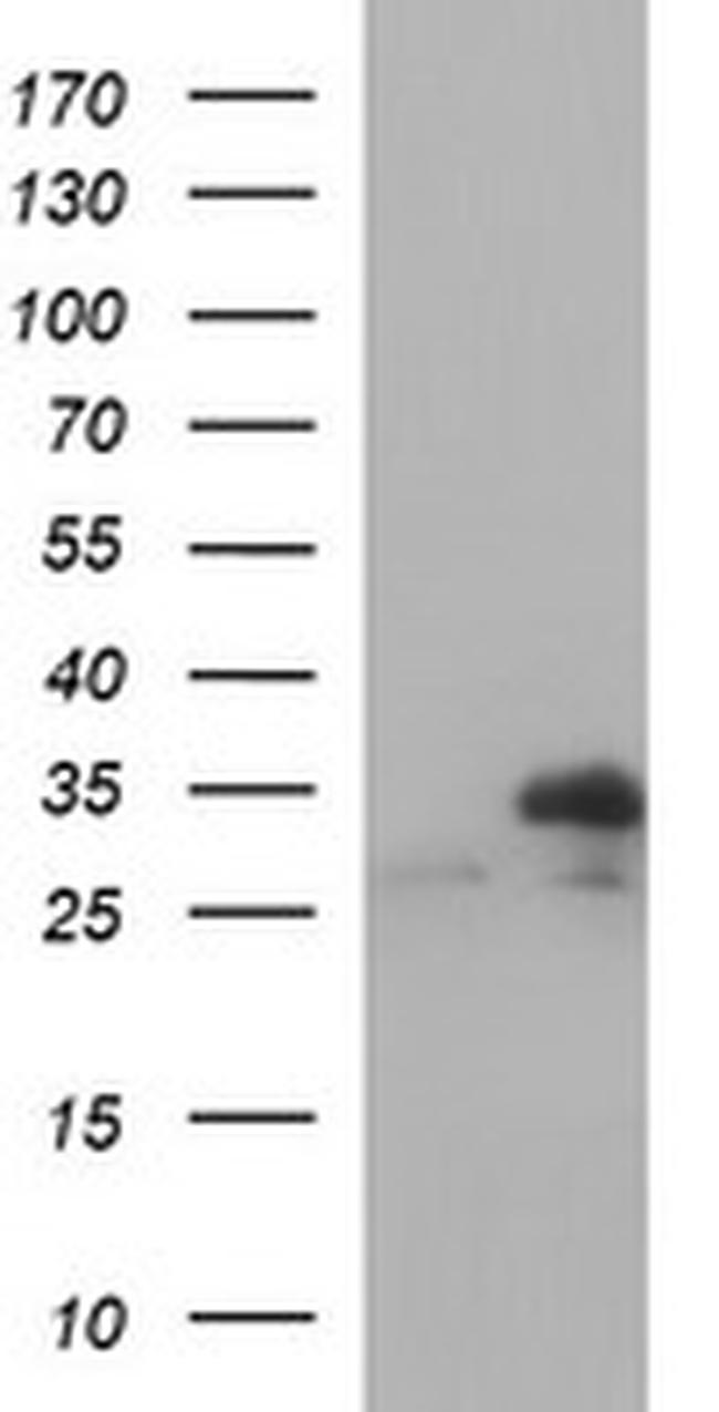 TMX1 Antibody in Western Blot (WB)